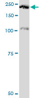 PLXNA2 / Plexin A2 Antibody - PLXNA2 monoclonal antibody (M06), clone 2G5. Western Blot analysis of PLXNA2 expression in Raw 264.7.