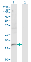 PLXNA2 / Plexin A2 Antibody - Western Blot analysis of PLXNA2 expression in transfected 293T cell line by PLXNA2 monoclonal antibody (M06), clone 2G5.Lane 1: PLXNA2 transfected lysate (Predicted MW: 18.8 KDa).Lane 2: Non-transfected lysate.