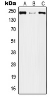 PLXNA2 / Plexin A2 Antibody - Western blot analysis of Plexin A2 expression in A549 (A); Raw264.7 (B); PC12 (C) whole cell lysates.