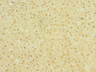 PLXNA2 / Plexin A2 Antibody - Immunohistochemistry of paraffin-embedded human adrenal gland tissue at dilution 1:100