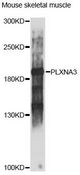 PLXNA3 / Plexin A3 Antibody - Western blot analysis of extracts of mouse skeletal muscle, using PLXNA3 antibody at 1:1000 dilution. The secondary antibody used was an HRP Goat Anti-Rabbit IgG (H+L) at 1:10000 dilution. Lysates were loaded 25ug per lane and 3% nonfat dry milk in TBST was used for blocking. An ECL Kit was used for detection and the exposure time was 30s.