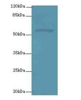 PLXNA4 / Plexin A4 Antibody - Western blot. All lanes: PLXNA4 antibody at 3 ug/ml+A54- whole cell lysate Goat polyclonal to rabbit at 1:10000 dilution. Predicted band size: 58 kDa. Observed band size: 58 kDa.