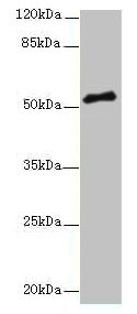 PLXNA4 / Plexin A4 Antibody - Western blot All lanes: PLXNA4 antibody at 3µg/ml + A549 whole cell lysate Secondary Goat polyclonal to rabbit IgG at 1/10000 dilution Predicted band size: 213, 56, 59, 40 kDa Observed band size: 56 kDa