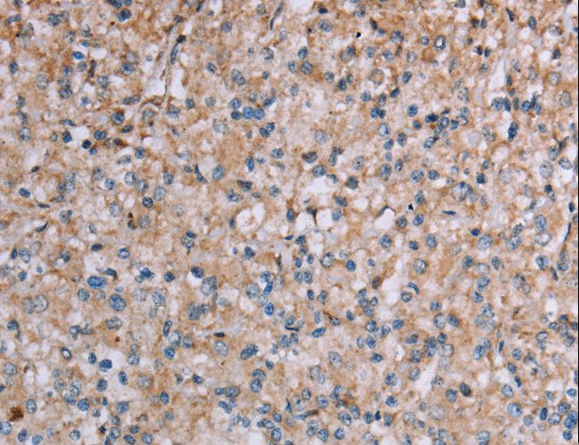 PLXNA4 / Plexin A4 Antibody - Immunohistochemistry of paraffin-embedded Human brain using PLXNA4 Polyclonal Antibody at dilution of 1:50.