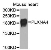 PLXNA4 / Plexin A4 Antibody - Western blot analysis of extracts of mouse heart cells.
