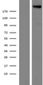 PLXNA4 / Plexin A4 Protein - Western validation with an anti-DDK antibody * L: Control HEK293 lysate R: Over-expression lysate