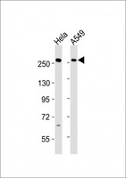 PLXNB1 / Plexin-B1 Antibody - All lanes : Anti-PLXNB1 Antibody at 1:2000 dilution Lane 1: HeLa whole cell lysates Lane 2: A549 whole cell lysates Lysates/proteins at 20 ug per lane. Secondary Goat Anti-Rabbit IgG, (H+L), Peroxidase conjugated at 1/10000 dilution Predicted band size : 232 kDa Blocking/Dilution buffer: 5% NFDM/TBST.