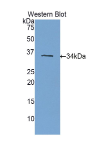 PLXNB1 / Plexin-B1 Antibody - Western blot of recombinant PLXNB1 / Plexin-B1.  This image was taken for the unconjugated form of this product. Other forms have not been tested.