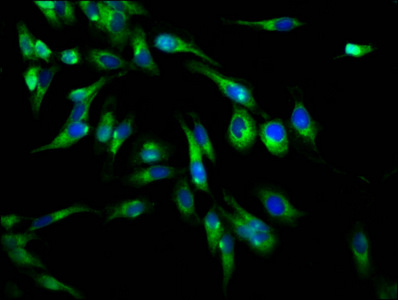 PLXNB1 / Plexin-B1 Antibody - Immunofluorescence staining of Hela cells at a dilution of 1:66, counter-stained with DAPI. The cells were fixed in 4% formaldehyde, permeabilized using 0.2% Triton X-100 and blocked in 10% normal Goat Serum. The cells were then incubated with the antibody overnight at 4 °C.The secondary antibody was Alexa Fluor 488-congugated AffiniPure Goat Anti-Rabbit IgG (H+L) .