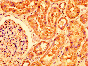 PLXNB1 / Plexin-B1 Antibody - Immunohistochemistry image at a dilution of 1:200 and staining in paraffin-embedded human kidney tissue performed on a Leica BondTM system. After dewaxing and hydration, antigen retrieval was mediated by high pressure in a citrate buffer (pH 6.0) . Section was blocked with 10% normal goat serum 30min at RT. Then primary antibody (1% BSA) was incubated at 4 °C overnight. The primary is detected by a biotinylated secondary antibody and visualized using an HRP conjugated SP system.