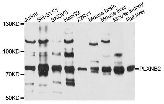 PLXNB2 / Plexin B2 Antibody - Western blot analysis of extracts of various cell lines, using PLXNB2 antibody at 1:1000 dilution. The secondary antibody used was an HRP Goat Anti-Rabbit IgG (H+L) at 1:10000 dilution. Lysates were loaded 25ug per lane and 3% nonfat dry milk in TBST was used for blocking. An ECL Kit was used for detection and the exposure time was 90s.