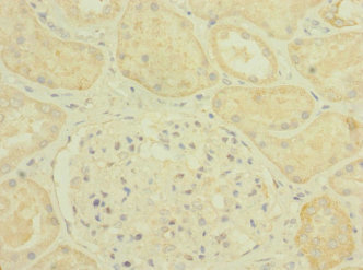 PLXNB2 / Plexin B2 Antibody - Immunohistochemistry of paraffin-embedded human kidney tissue at dilution 1:100
