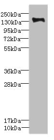 PLXNB2 / Plexin B2 Antibody - Western blot All Lanes: PLXNB2 antibody IgG at 2.39ug/ml+ Mouse liver tissue Secondary Goat polyclonal to rabbit IgG at 1/10000 dilution Predicted band size: 205 kDa Observed band size: 205 kDa