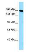 PLXNB3 / Plexin B3 Antibody - PLXNB3 / Plexin B3 antibody Western Blot of Jurkat.  This image was taken for the unconjugated form of this product. Other forms have not been tested.