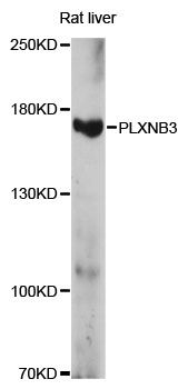 PLXNB3 / Plexin B3 Antibody - Western blot analysis of extracts of rat liver, using PLXNB3 antibody at 1:1000 dilution. The secondary antibody used was an HRP Goat Anti-Rabbit IgG (H+L) at 1:10000 dilution. Lysates were loaded 25ug per lane and 3% nonfat dry milk in TBST was used for blocking. An ECL Kit was used for detection and the exposure time was 15s.