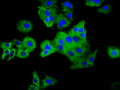 PLXNC1 / Plexin C1 Antibody - Immunofluorescence staining of HepG2 cells diluted at 1:33, counter-stained with DAPI. The cells were fixed in 4% formaldehyde, permeabilized using 0.2% Triton X-100 and blocked in 10% normal Goat Serum. The cells were then incubated with the antibody overnight at 4°C.The Secondary antibody was Alexa Fluor 488-congugated AffiniPure Goat Anti-Rabbit IgG (H+L).