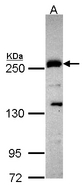 PLXND1 / Plexin D1 Antibody - Sample (30 ug of whole cell lysate). A: Hep G2 . 5% SDS PAGE. PLXND1 / Plexin D1 antibody diluted at 1:1000.