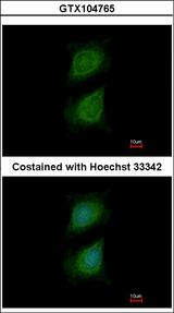 PLXND1 / Plexin D1 Antibody - Immunofluorescence of methanol-fixed HeLa using Plexin D1 antibody at 1:500 dilution.