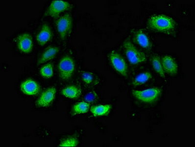 PLXND1 / Plexin D1 Antibody - Immunofluorescent analysis of A549 cells diluted at 1:100 and Alexa Fluor 488-congugated AffiniPure Goat Anti-Rabbit IgG(H+L)