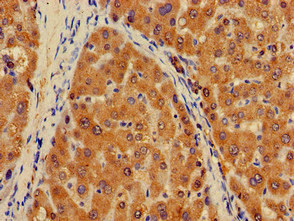PLXND1 / Plexin D1 Antibody - Immunohistochemistry of paraffin-embedded human liver tissue at dilution of 1:100