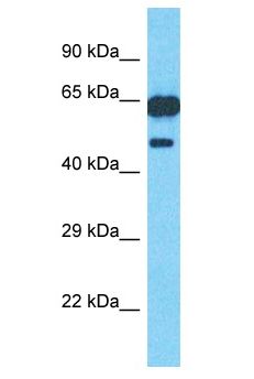 PM20D1 Antibody - PM20D1 antibody Western Blot of 293T. Antibody dilution: 1 ug/ml.  This image was taken for the unconjugated form of this product. Other forms have not been tested.