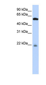 PM20D2 / ACY1L2 Antibody - PM20D2 antibody Western blot of 721_B cell lysate. This image was taken for the unconjugated form of this product. Other forms have not been tested.