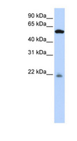 PM20D2 / ACY1L2 Antibody - PM20D2 antibody Western blot of 721_B cell lysate. This image was taken for the unconjugated form of this product. Other forms have not been tested.