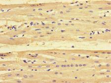 PMAIP1 / NOXA Antibody - Immunohistochemistry of paraffin-embedded human heart tissue at dilution of 1:100