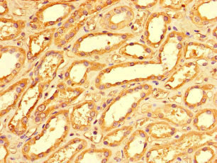 PMAIP1 / NOXA Antibody - Immunohistochemistry of paraffin-embedded human kidney tissue at dilution of 1:100
