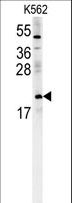 PMCH / MCH Antibody - PMCH Antibody western blot of K562 cell line lysates (15 ug/lane). The PMCH antibody detected the PMCH protein (arrow).