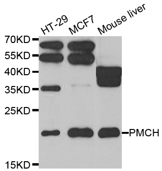 PMCH / MCH Antibody - Western blot analysis of extracts of various cell lines.