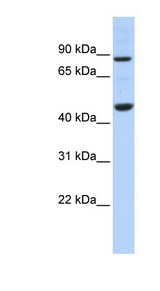 PME-1 / PPME1 Antibody - PPME1 antibody Western blot of 721_B cell lysate. This image was taken for the unconjugated form of this product. Other forms have not been tested.