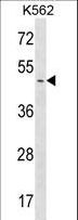 PME-1 / PPME1 Antibody - PPME1 Antibody western blot of K562 cell line lysates (35 ug/lane). The PPME1 antibody detected the PPME1 protein (arrow).