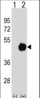 PME-1 / PPME1 Antibody - Western blot of PPME1 (arrow) using rabbit polyclonal PPME1 Antibody. 293 cell lysates (2 ug/lane) either nontransfected (Lane 1) or transiently transfected (Lane 2) with the PPME1 gene.