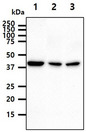 PME-1 / PPME1 Antibody - The cell lysates (40ug) were resolved by SDS-PAGE, transferred to PVDF membrane and probed with anti-human PPME1 antibody (1:1000). Proteins were visualized using a goat anti-mouse secondary antibody conjugated to HRP and an ECL detection system. Lane 1.: HeLa cell lysate Lane 2.: K562 cell lysate Lane 3.: A549 cell lysate