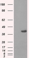 PME-1 / PPME1 Antibody - HEK293T cells were transfected with the pCMV6-ENTRY control (Left lane) or pCMV6-ENTRY PPME1 (Right lane) cDNA for 48 hrs and lysed. Equivalent amounts of cell lysates (5 ug per lane) were separated by SDS-PAGE and immunoblotted with anti-PPME1.