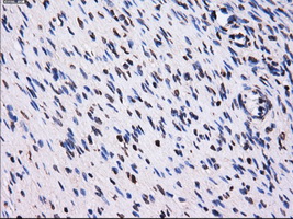 PME-1 / PPME1 Antibody - IHC of paraffin-embedded Ovary tissue using anti-PPME1 mouse monoclonal antibody. (Dilution 1:50).
