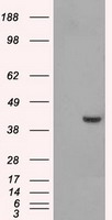 PME-1 / PPME1 Antibody - HEK293T cells were transfected with the pCMV6-ENTRY control (Left lane) or pCMV6-ENTRY PPME1 (Right lane) cDNA for 48 hrs and lysed. Equivalent amounts of cell lysates (5 ug per lane) were separated by SDS-PAGE and immunoblotted with anti-PPME1.