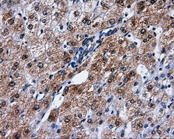 PME-1 / PPME1 Antibody - Immunohistochemical staining of paraffin-embedded liver tissue using anti-PPME1 mouse monoclonal antibody. (Dilution 1:50).