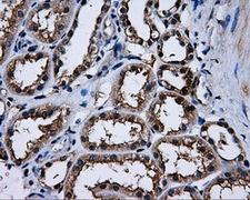 PME-1 / PPME1 Antibody - IHC of paraffin-embedded Kidney tissue using anti-PPME1 mouse monoclonal antibody. (Dilution 1:50).