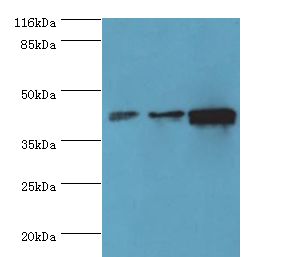 PME-1 / PPME1 Antibody - Western blot. All lanes: PPME1 antibody at 2 ug/ml. Lane 1: A549 whole cell lysate Lane 2: HeLa whole cell lysate Lane 3: Mouse brain tissue. Secondary antibody: goat polyclonal to rabbit at 1:10000 dilution. Predicted band size: 42 kDa. Observed band size: 42 kDa.  This image was taken for the unconjugated form of this product. Other forms have not been tested.