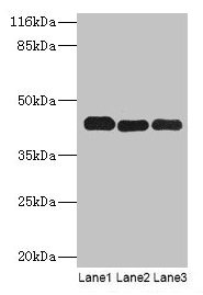 PME-1 / PPME1 Antibody - Western blot All lanes: PPME1 antibody at 2µg/ml Lane 1: A549 whole cell lysate Lane 2: Hela whole cell lysate Lane 3: Mouse brain tissue Secondary Goat polyclonal to rabbit IgG at 1/10000 dilution Predicted band size: 43, 23, 19, 44 kDa Observed band size: 43 kDa