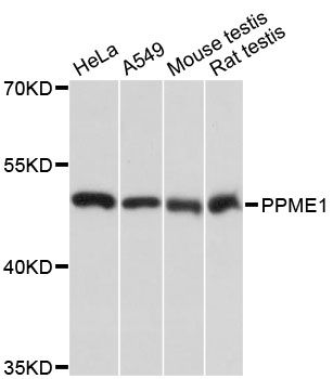 PME-1 / PPME1 Antibody - Western blot analysis of extracts of various cell lines, using PPME1 antibody at 1:3000 dilution. The secondary antibody used was an HRP Goat Anti-Rabbit IgG (H+L) at 1:10000 dilution. Lysates were loaded 25ug per lane and 3% nonfat dry milk in TBST was used for blocking. An ECL Kit was used for detection and the exposure time was 1s.