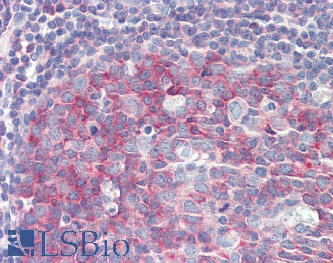 PMEL / SILV / gp100 Antibody - Anti-PMEL / SILV / gp100 antibody IHC staining of human tonsil. Immunohistochemistry of formalin-fixed, paraffin-embedded tissue after heat-induced antigen retrieval.  This image was taken for the unconjugated form of this product. Other forms have not been tested.