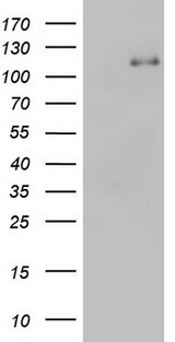 PMEL / SILV / gp100 Antibody - HEK293T cells were transfected with the pCMV6-ENTRY control (Left lane) or pCMV6-ENTRY SILV (Right lane) cDNA for 48 hrs and lysed. Equivalent amounts of cell lysates (5 ug per lane) were separated by SDS-PAGE and immunoblotted with anti-SILV.