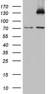 PMEL / SILV / gp100 Antibody - HEK293T cells were transfected with the pCMV6-ENTRY control (Left lane) or pCMV6-ENTRY SILV (Right lane) cDNA for 48 hrs and lysed. Equivalent amounts of cell lysates (5 ug per lane) were separated by SDS-PAGE and immunoblotted with anti-SILV.