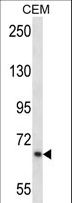 PMEL / SILV / gp100 Antibody - SILV Antibody western blot of CEM cell line lysates (35 ug/lane). The SILV antibody detected the SILV protein (arrow).