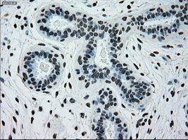 PMEL / SILV / gp100 Antibody - IHC of paraffin-embedded breast tissue using anti-SILV mouse monoclonal antibody. (Dilution 1:50).
