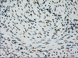 PMEL / SILV / gp100 Antibody - IHC of paraffin-embedded endometrium tissue using anti-SILV mouse monoclonal antibody. (Dilution 1:50).