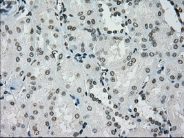 PMEL / SILV / gp100 Antibody - IHC of paraffin-embedded Kidney tissue using anti-SILV mouse monoclonal antibody. (Dilution 1:50).